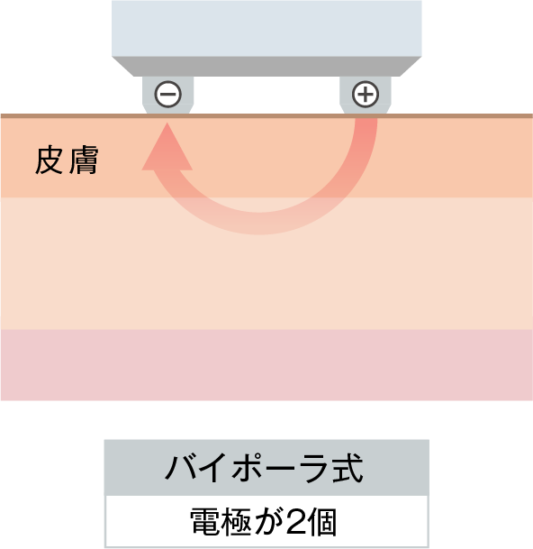 バイポーラ式 電極が2個